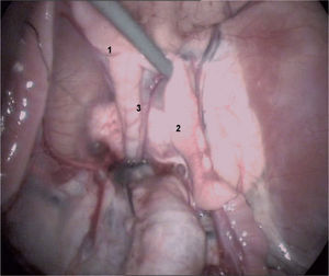 Anatomía del aparato genital interno de la cerda.
