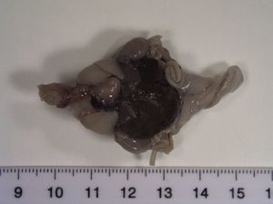 Vista frontal de los órganos torácicos y abdominales de uno de los siameses.