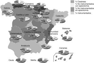 Distribución de los diferentes tipos de parto por Comunidades Autónomas, año 2006.