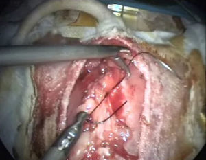 Realización de suturas laparoscópicas.