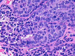 Células columnares con citoplasma claro y núcleo vesiculoso apoyada sobre una capa de células mioepiteliales.