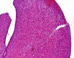 Estroma densamente celular (HE×400).