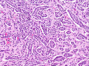 Imagen microscópica: cordones de células de Sertoli, entre los que se observan algunas células de Leydig (HE, ×20).