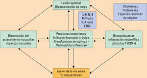 Patogenia de las bronquiectasias. IL: interleuquina; LTB4: leucotrieno B4; TNF: factor de necrosis tumoral. Adaptada de Fuschillo S, et al3. Patogenia de las bronquiectasias. IL: interleuquina; LTB4: leucotrieno B4; TNF: factor de necrosis tumoral. Adaptada de Fuschillo S, et al3.