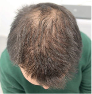 Fig. 2