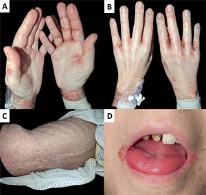 Fig. 2