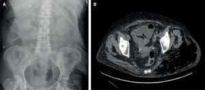 Fig. 2
