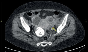 Fig. 1