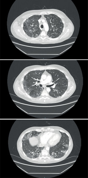 Fig. 2