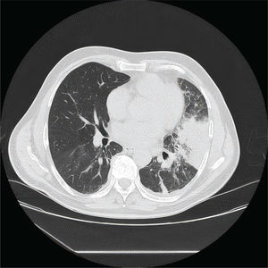 Fig. 2