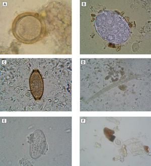 Fig. 4
