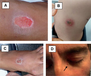 Fig. 4
