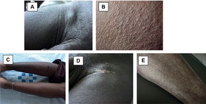 Fig. 6