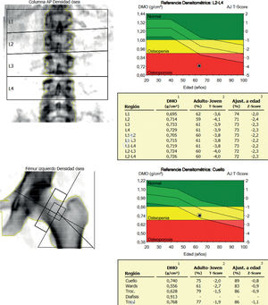 Fig. 2