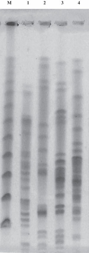 PFGE de ADN genómico digerido con XbaI de aislamientos clínicos de Enterobacter cloacae portadores del gen blaIMP-8. M: Marcador de peso molecular PFG-Marker; calle 1: ECL-M9921; calle 2: ECL-M13280; calle 3: ECL-M13624; y calle 4: ECL-M13795.