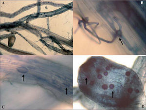 A. Raíces micorrizadas de alfalfa con nódulo teñidas con azul de Tripán (100X). B. Apresorio de MA (1000X). C. Vesículas y arbúsculos (100X). D. Nódulos con esporas y micelio en su interior (400X).