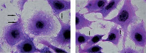 Observation of Campylobacter fetus subsp. venerealis adhered to MDBK cells. Giemsa stain, 100X.