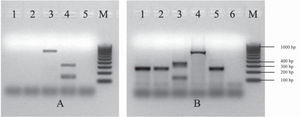 Multiplex PCRs (mPCR) used as screening of EPEC, ETEC, STEC, EIEC and EAEC. A. Multiplex PCR1 for the detection of eae, lt, and st genes. Lane 1: confluent culture of the diarrhea case; lane 2: isolated colony of the diarrhea case; lane 3: E. coli 2348/69 positive control for the eae gene (864 bp); lane 4: E. coli H10407 positive control for lt/st genes (322, 147 bp); line 5: reagent control; M: 100 kb molecular size marker. B. Multiplex PCR2 for the detection of IpaH, aggR, stx1 and stx2 genes. Lane 1: confluent culture of the diarrhea case; lane 2: isolated colony of the diarrhea case; lane 3: E. coli 110/05 positive control for stx1/stx2 genes (130, 346 bp); lane 4: E. coli C-481 positive control for the IpaH gene (619 bp); lane 5: E. coli 17-2 positive control for the aggR gene (254 bp); lane 6: reagent control; M: 100 kb molecular size marker.