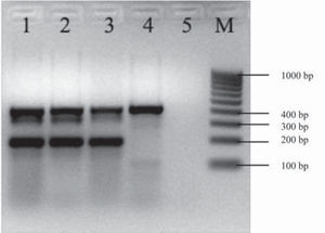 Multiplex PCR for detection of rfbO104, fliCH4, and terD genes. Multiplex PCR for the detection of rfbO104, fliCH4, and terD genes. Lane 1: confluent culture of the diarrhea case; lane 2: isolated colony of the diarrhea case; lane 3: E. coli 870 positive control for the terD gene (434 bp), rfbO104 gene (351 bp) and fliCH4 gene (201 bp); E. coli FP595/11 lane 4 positive control for the terD gene (434 bp); lane 5: reagent control; M: 100 kb molecular size marker.