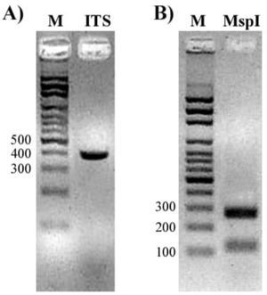 A. Gel de agarosa que muestra el producto amplificado (ITS1-5.8S-ITS4) de C. lusitaniae. B. Fragmentos de restricción del producto de PCR obtenidos con la enzima MspI (RFLP). M: marcador de peso molecular, escalera de 100 pb.