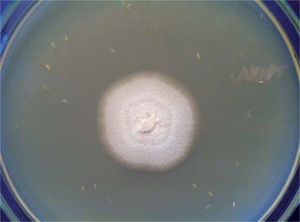 Colonia de Sporothrix pallida complex aislado de paciente con onicomicosis (PDA; 7 días de incubación a 30°C).