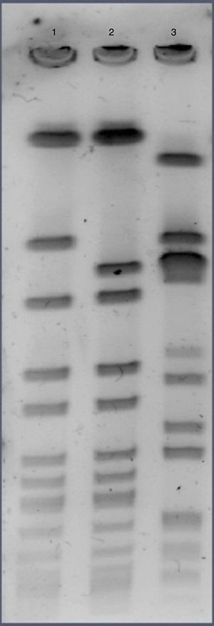 PFGE pattern of the strain recovered in blood specimens and prevalent community acquired MRSA clones in Argentina. Lane 1: MRSA from this communication. Lane 2: CA-MRSA clone ST30-SCCmecIVc-spat019-PVL positive. Lane 3: CA-MRSA clone ST5-SCCmecIVa-spat311-PVL positive.