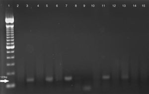 Electrophoresis of IS6110 PCR amplifications. Line 1 – 100bp (bp=base pair(s) in DNA) DNA ladder; Line 2 – negative control; Line 3 – positive control – M. tuberculosis H37RV; Lines: 4, 6, 8, 9, and 10 – NTM samples; Lines: 5, 7, 11, and 13 – MTB samples; Lines: 14 and 15 – negative samples.