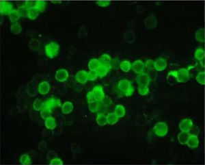 Detección por inmunofluorescencia del BoHV-4 cepa 07/435 en células MDBK (magnificación 200X).