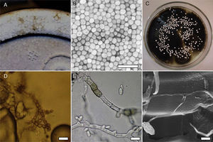 (A and B) Stained polystyrene products. (C) Colony emerging from unexpanded beads in MEA. (D) Mycelium observed under light microscope in the expanded material. (E) Structures observed in pure culture incubated for 30 days at 28°C in MEA showing conidiogenous cells, conidia, and melanized cells. (F) Superficial colonization of the beads by hyphae under SEM. Scale bar (B)=1cm and (D–F)=10μm.