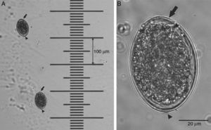Eggs of Diphyllobothrium sp. in feces of Canis familiaris. (A) Eggs of Diphyllobothrium sp. at 100×. On the right, a micrometer ruler 1/100mm. (B) Eggs of Diphyllobothrium sp. at 400×. Reference bar, 20μm. In both images the black arrow indicates the operculum and the arrowhead the small knob at the opposite end.
