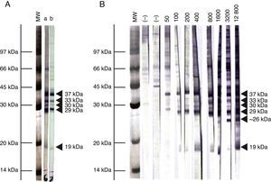 Representative pattern of N. caninum immunodominant antigen recognition in A) naturally and experimentally infected cattle and B) naturally exposed cattle at different IFAT titers. MW= molecular weight pattern; a= sera from a naturally infected cow; b= sera from an experimentally infected heifer; (–)= seronegative cow; IFAT titers are expressed as the reciprocal of the highest serum dilution showing positive fluorescence.