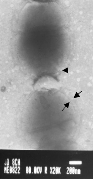 Capsule observation by transmission electronic microscope of Streptococcus equi subsp. equi showing low levels of capsule expression.