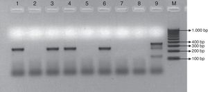 PCR múltiple para la detección de los genes stx1, stx2, y rfbO157. Línea 1: aislamiento de E. coli de la primera muestra del caso de diarrea; línea 2: zona de crecimiento confluente en SMAC de la segunda muestra del caso de diarrea; línea 3: aislamiento de E. coli de la muestra del padre; línea 4: aislamiento de E. coli de la muestra de la madre; línea 5: zona de crecimiento confluente en SMAC de la muestra del hermano; línea 6: aislamiento de E. coli de la muestra de la hermana; línea 7: zona de crecimiento confluente en SMAC de la muestra de la abuela paterna; línea 8: control de reactivos; línea 9: E. coli 110/05 control positivo para stx1 (130bp), stx2 (346bp) y rfbO157 (259bp). M: marcador de tamaño molecular Cien Marker.