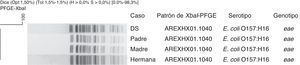 Relación clonal por XbaI-PFGE de las cepas de Escherichia coli O157:H16 aisladas de un caso de diarrea sanguinolenta y de sus contactos familiares.