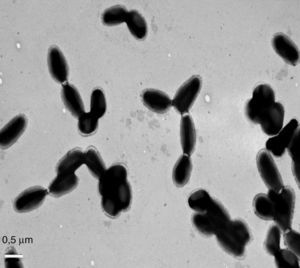 Mediante microscopia electrónica de transmisión se observan células teñidas con acetato de uracilo al 1% deslizándose en medio Middlebrook con 0,3% agar, luego de 15 días de incubación.