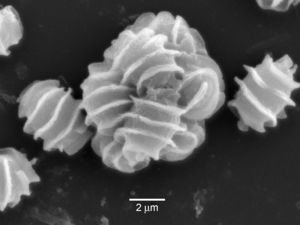 Ascus of T. udagawae with eight ascospores observed by scanning electron microscopy.