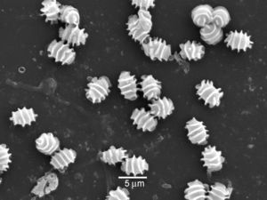 Ascopores of T. udagawae under scanning electron microscopy.