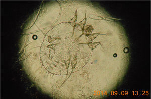 Imagen microscópica sin tinción de adulto de Sarcoptes scabiei (400×).