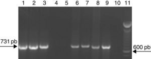 Amplificación de fragmentos de ADN de 731 pb específico para B. melitensis mediante AMOS-PCR. Calles 1, 2 y 3: muestras de ADN de los aislamientos correspondientes a las cabras 188, 200 y 911 de la majada MJ2 (Colonia Km 503). Calles 4 a 8: muestras de ADN de leche de las cabras 105,184 (negativas), 188, 200 y 911 (infectadas). Calle 9: cepa de referencia de B. melitensis bv. 1. Calle 10: control negativo. Calle 11: marcador molecular de 100 pb (Invitrogen, EE. UU.).