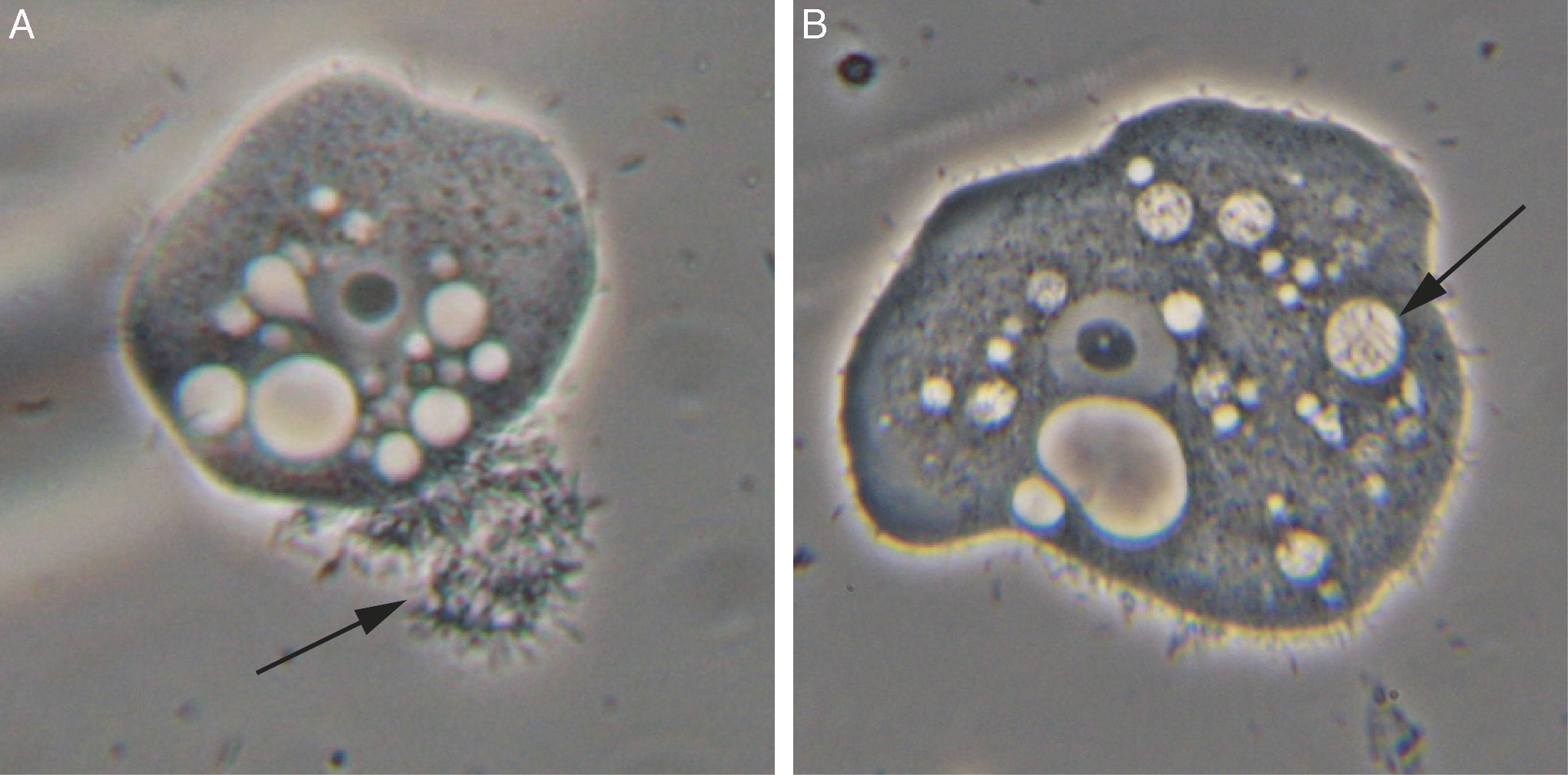 Arcobacter butzleri survives within trophozoite of Acanthamoeba ...