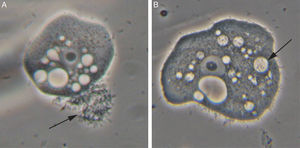 Phase contrast microscopy. (A) Trophozoite of A. castellanii showing A. butzleri seen in close association with A. castellanii gathering at one pole of the amoeba cell known as food-cup (30min of co-incubation). (B) Trophozoite of A. castellanii showing A. butzleri within the amoebic vacuoles (50min of co-incubation).