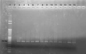 DNA amplification of Toxocara spp. isolated from R. decollata snails by PCR on 2.5% agarose gel, using the pair of primers 5′-ACGTATGCGTGAGCCG-3′ and 5′-GTGTTTTTGGTTTTTGGCG-3′: lane 1: marker 50bp; lane 2: negative control; lane 3–14: amplification of DNA from different isolated larvae, each lane corresponds to a single larva; lane 15: DNA from T. cati larvae isolated from cats feces, positive control.
