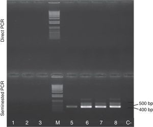 Detection of S. aucheniae DNA in the blood of llamas from Jujuy, Argentina. DNA extracted from blood aliquots of llamas from the Province of Buenos Aires (lanes 1–3: animals No. 26, 34 and 137, respectively) and Jujuy (lanes 5–8: animals No. L_1022, L_1034, L_863, L_961, respectively) was amplified by seminested PCR and analyzed by gel electrophoresis, as in Figure 2. M: 1kb Plus DNA marker; C−; negative control. Note the presence of a main ∼400bp band in the four samples from Jujuy.