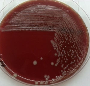 Placa de agar sangre ovina al 5% con colonias blanco grisáceas, γ-hemolíticas, de 2mm de diámetro. Incubación 48 h.