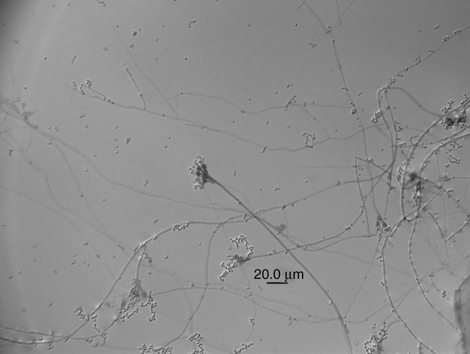 Pathologic Spider Contribution to the knowledge of pathogenic fungi of spiders in ...