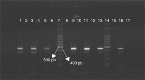 Diferenciación por PCR de cepas de Campylobacter jejuni O:19 y no O:19 utilizando primers específicos. Cepas O:19 líneas 1, 3 y 5, y cepas no O:19 líneas 9, 11 y 13. Cepa de referencia C. jejuni ATCC 33560 línea 16. Control negativo de reacción línea 17. Marcador de peso molecular línea 7 y 14.