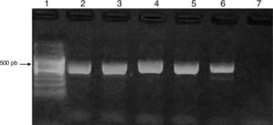 Amplificación de DF3 específico para Acanthamoeba spp. Calles: 1) marcador de peso molecular de 100 pb (PB-L). 2) Control positivo. 3, 4, 5 y 6) Muestras positivas de aguadas. 7) Control negativo.