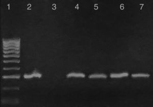 Characterization of kDNA-PCR-positive samples from infected reservoirs: Lane 1: 100-bp DNA ladder; 2: T. cruzi positive control; 3: negative control; 4 and 5: representative amplicons from DNA extracted from a T. cruzi-infected adult dog and a mixed-breed puppy in acute phase from metropolitan and rural areas, respectively; 6: representative sample of positive PCR from woodrats; 7: PCR product from a striped skunk.