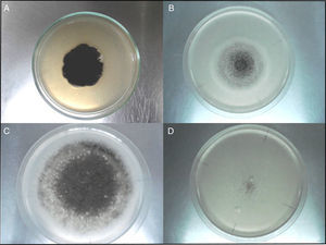 Morphological characteristics of colonies from A. niger aggregate strains in control Czapek Dox medium (CZ) (A), Czapek Dox medium without sucrose and supplied with glyphosate as the only carbon source CZC (B), Czapek Dox medium without K2HPO4 or NaNO3 and supplied with glyphosate as the only phosphorus CZP (C) and nitrogen source CZN (D), at 10 days of incubation.