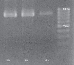 RT-PCR from purified samples (M1, M2 and M3) runned in a 1.5% agarose gel. L: 100bp Mass Ruler (Promega).